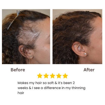 Batana Natural Hair Growth Oil